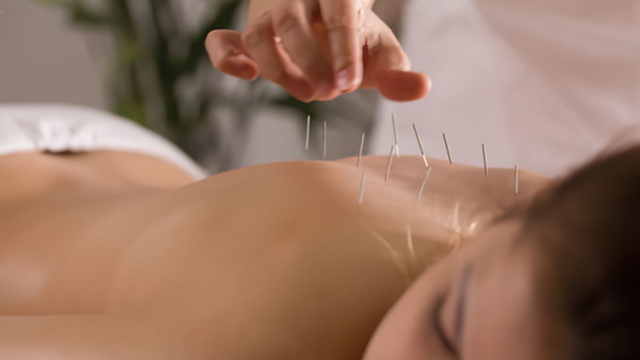 Acupuncture Diploma Online in Madison: A Career in Holistic Health - Businessfig