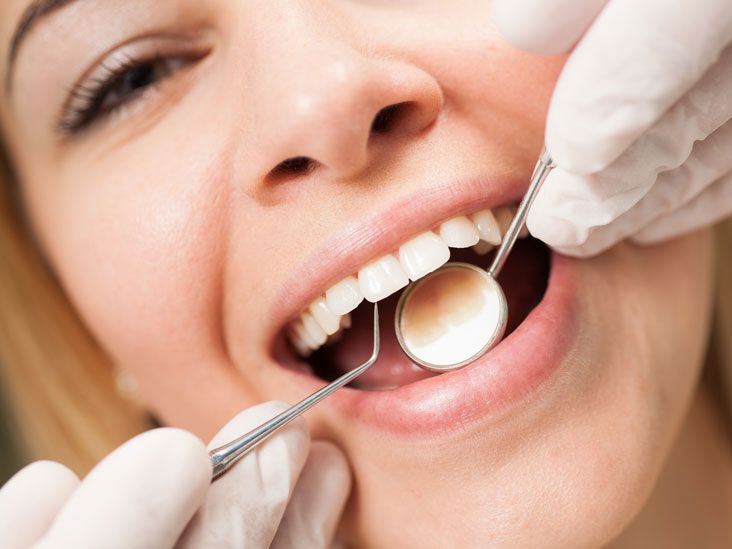What Can Your Dentist Spot During a Routine Cleaning and Exam? – Telegraph