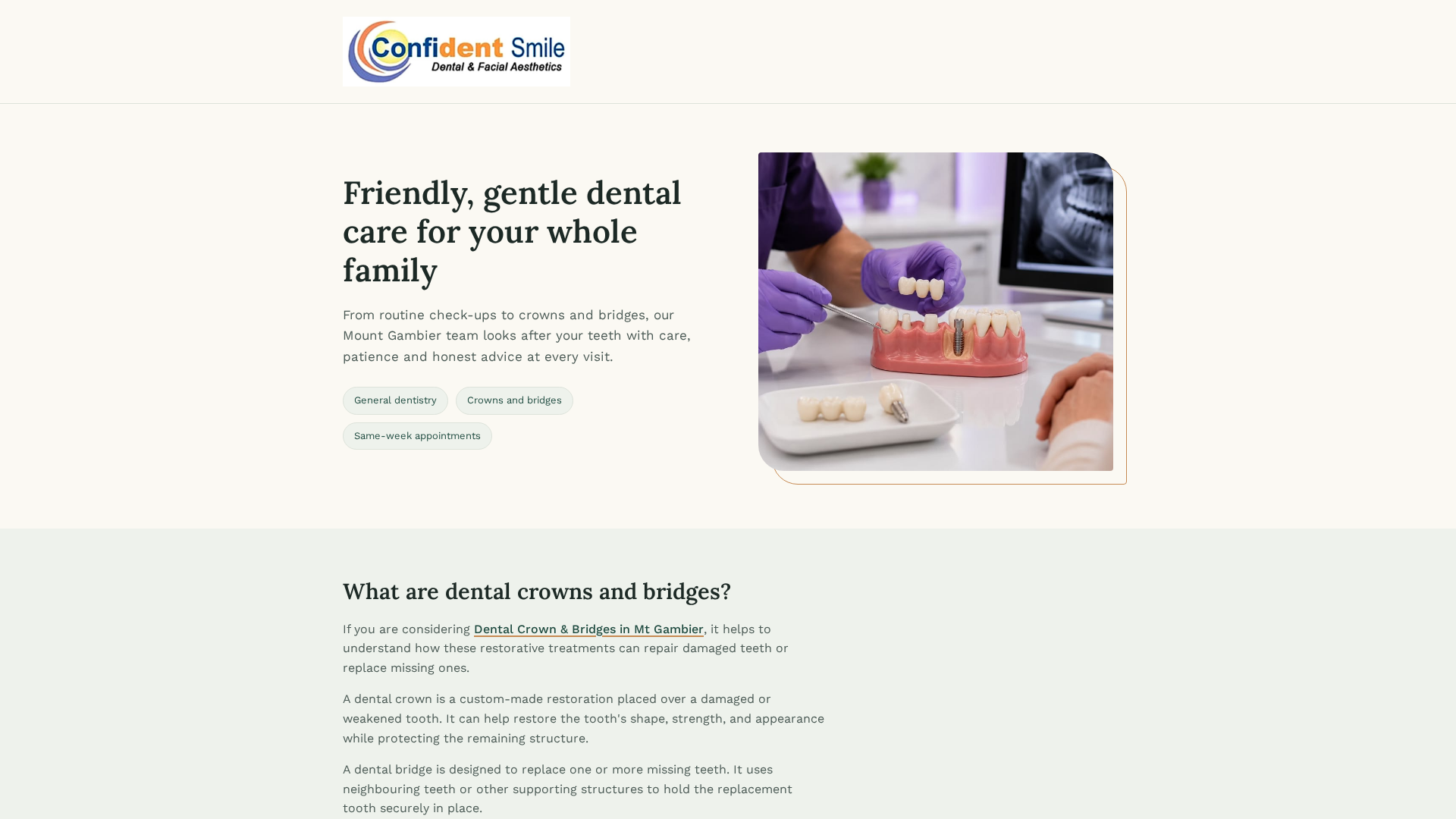 Dental Crown & Bridges in Mt Gambier | Confident Smiles
