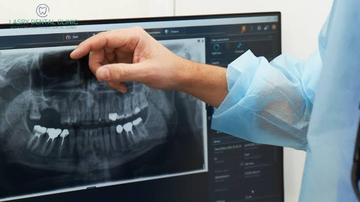 Why Might Your Dentist Take New X-Rays Even When You Have No Tooth...